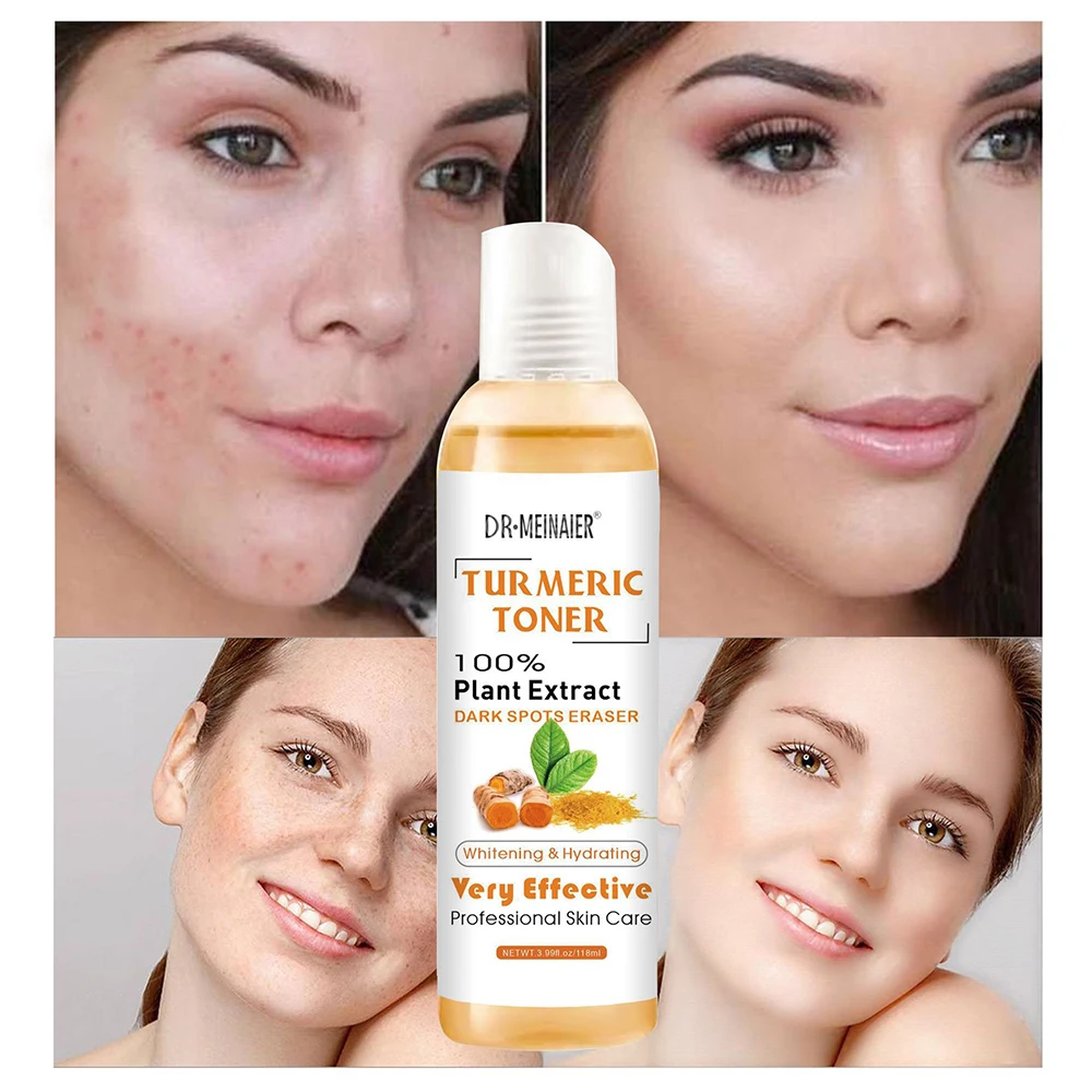 

Tumeric Dark Spots Toner Spots Eraser Corrector Turmeric Fade Blemishes Dark Spot Remover Acne Remover Toner for Dark Skin 118ml