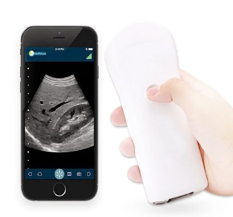 

House hold pregnancy doppler sonicaid one fetal doppler ucuz