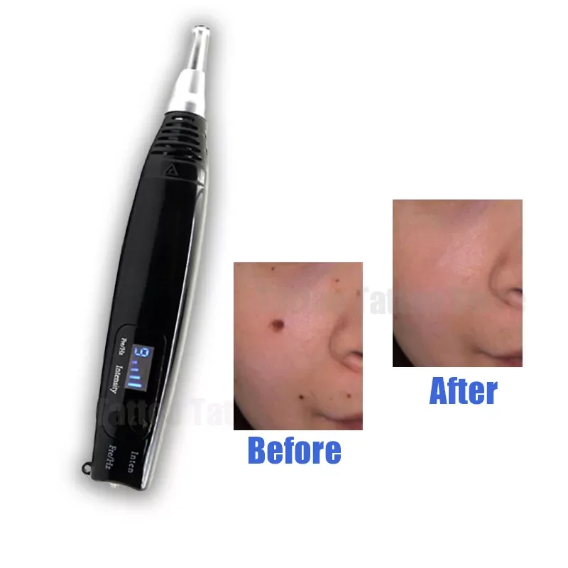 Professional Picosecond Laser Pen Tattoo Scar Removal Mole Acne Freckle Pigment Dark Spot Remover Machine Portable Beauty Skin C