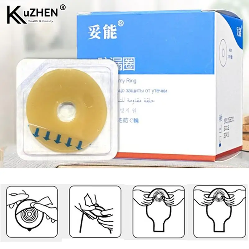 

Ostomy Paste Ring Baseplates Stoma Care Products Leak-proof Ring For Ostomy Bag Stretch Shaping To Prevent Leakage Protect Skin