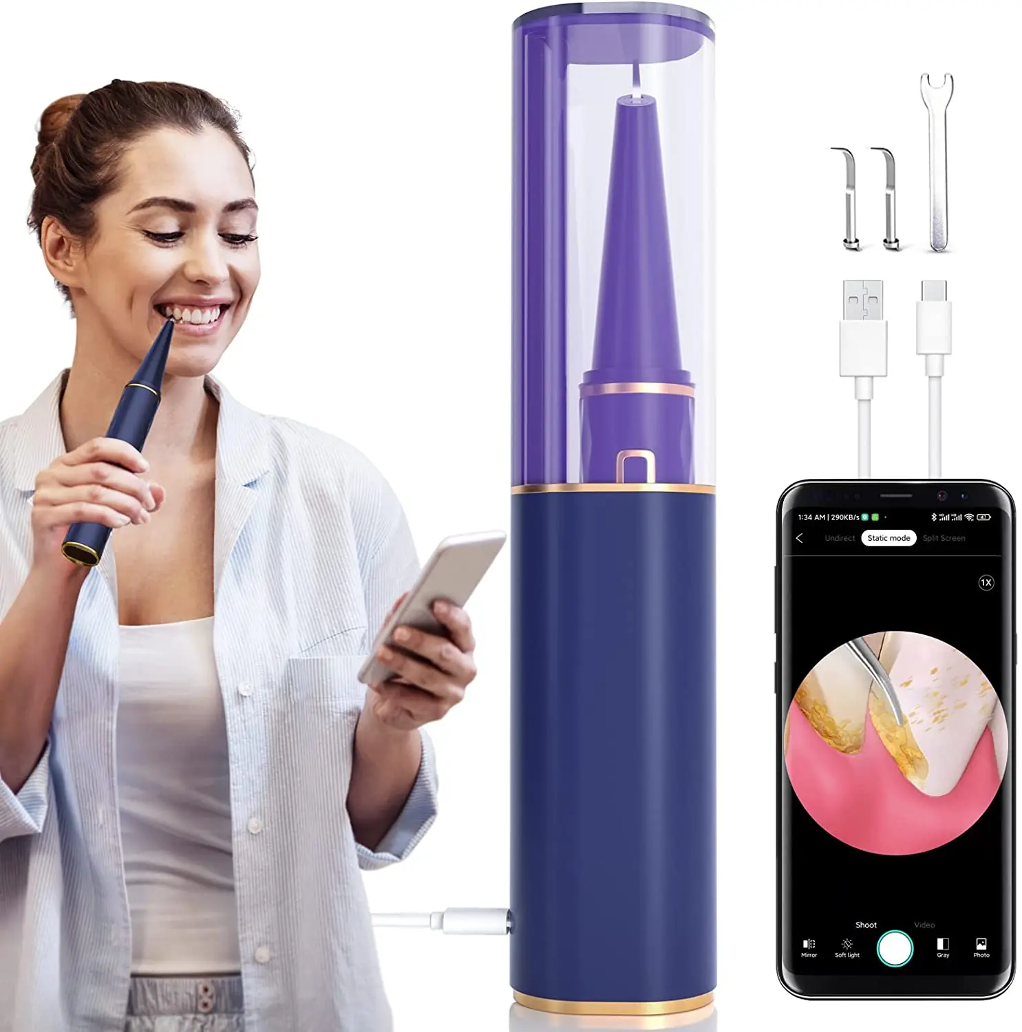 

Timesiso Ultrasonic Dental Cleaning Machine Electric Dental Calculus Plaque Removal Teeth Tartar Remover