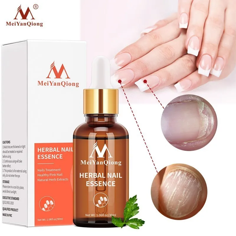 

Средство для ухода за ногтями, масло для удаления грибка, Лечение ногтей, эссенция против инфекции, масло для восстановления грибка пароних...