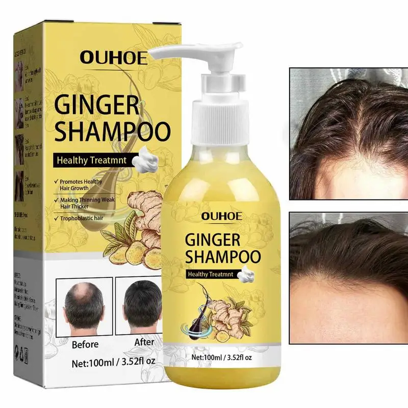 

Ginger Hair Shampoo Hair Growth Oil Control Anti Scalp Itching Cleansing Professional Natural Hair Shampoo 100ml