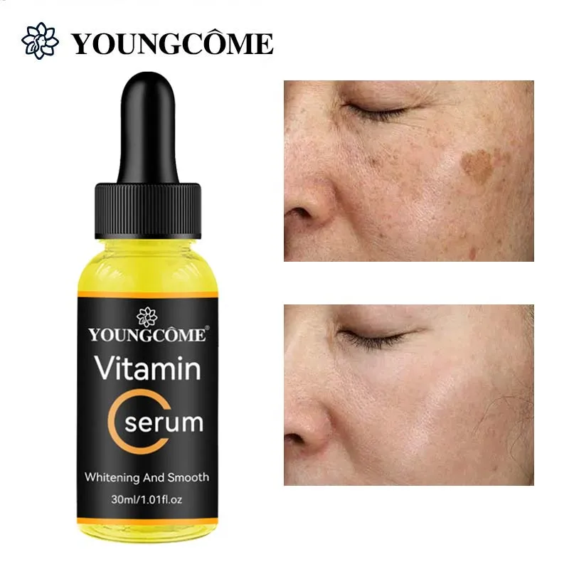 

Vitamin C Face Serum Whitening Brightening Freckle Fade Dark Spot Removal Pigment Melanin Correcting Essence Face Skin Care