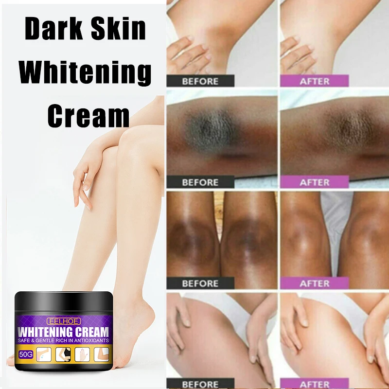 

Women Dark Skin Whitening Cream Bleaching Cream Face Body Whiten Underarm Private Parts Armpit Arms Legs Neck Elbows Knees