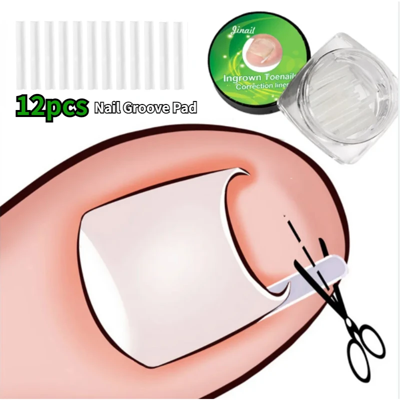 Рисунок 2 - Инструмент для коррекции вросших ногтей