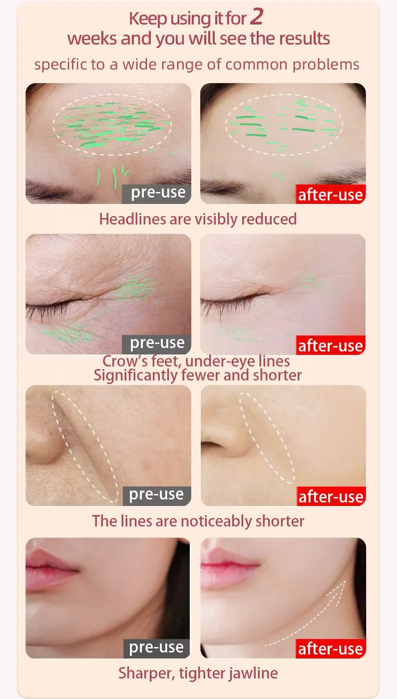 Массажер для лица вращающаяся на 360 градусов головка микротоковый вибрационный