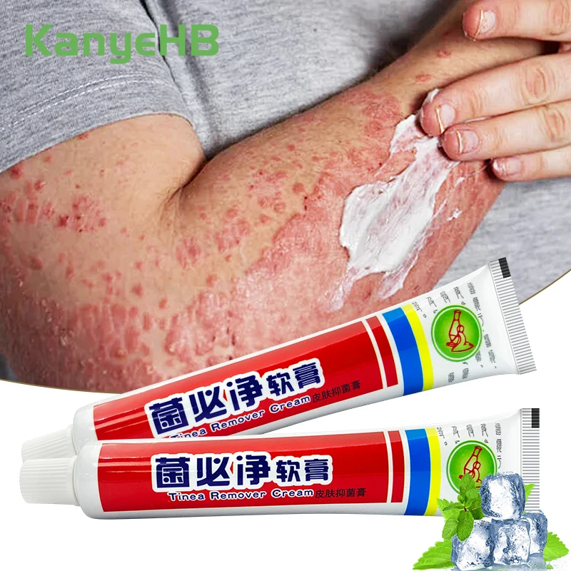 

2Pcs Psoriasis Cream For Dermatitis And Eczema Anti-Itch Herbal Medical Skin Care Oitnment Treat Tinea Pedis Skin Disease A1319