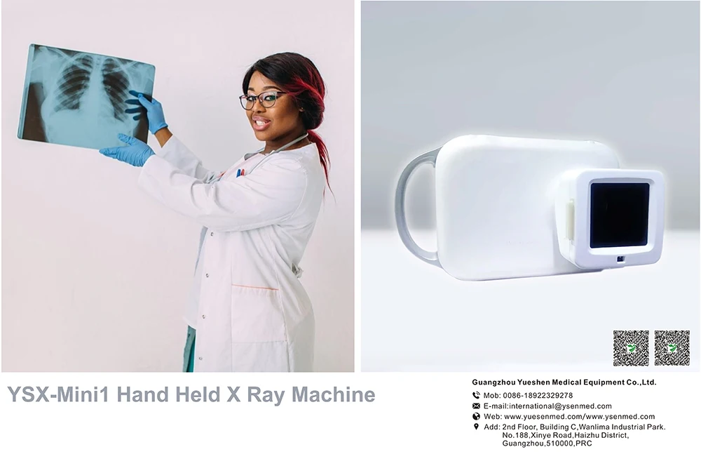Портативный рентгеновский аппарат Ysenmed YSX-Mini1 портативный для диагностики