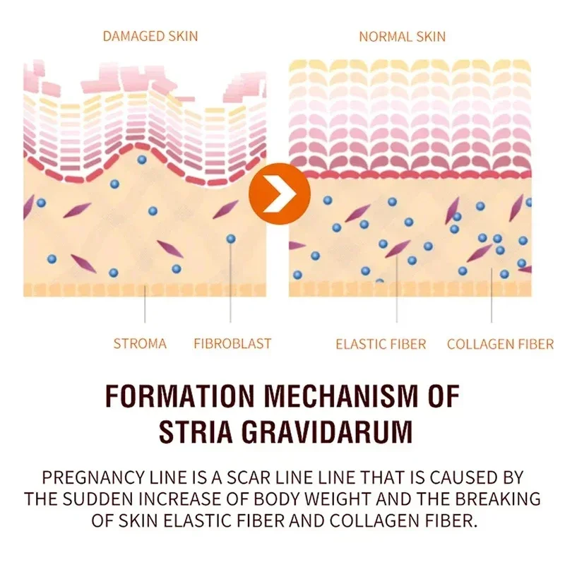 Восстанавливающий Крем для растяжек 20 г