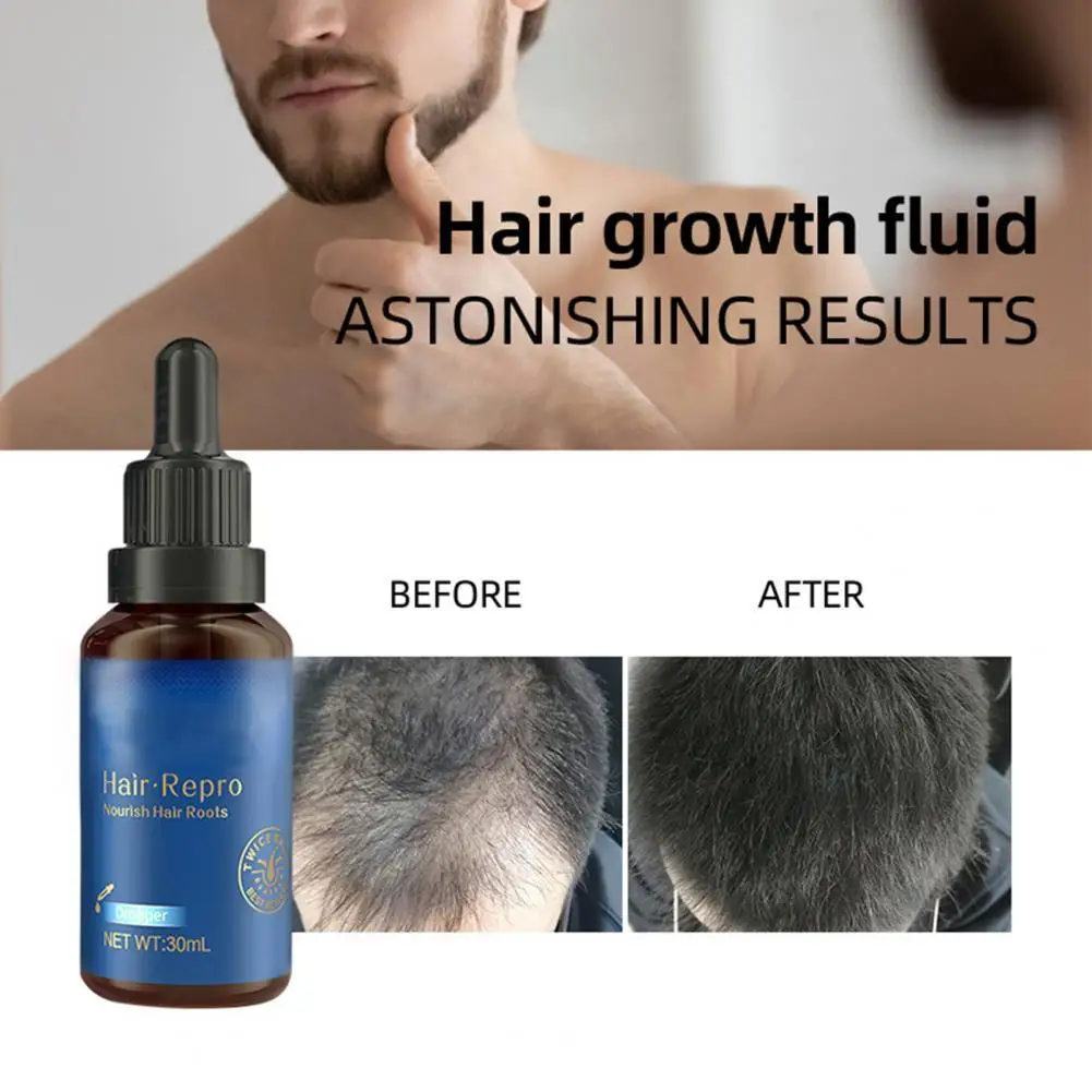 

Nourish Scalp External Use Growth Repair Essence Oil Hair Loss Treatment for Men Women