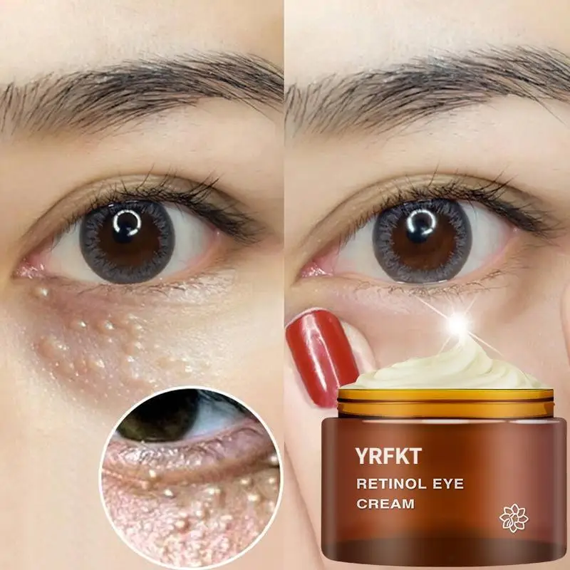

Retinol Eye Cream Dark Circles Fade Fine Lines Remove Eye Bags Firming Brighten Skin