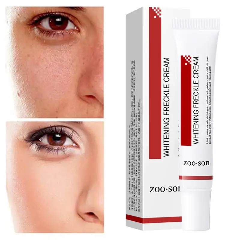 

Pigmentation Removal Cream Safe Skin Lightening Cream for Dark Skin Effective Hydrating Whitening Cream Corrector Creams