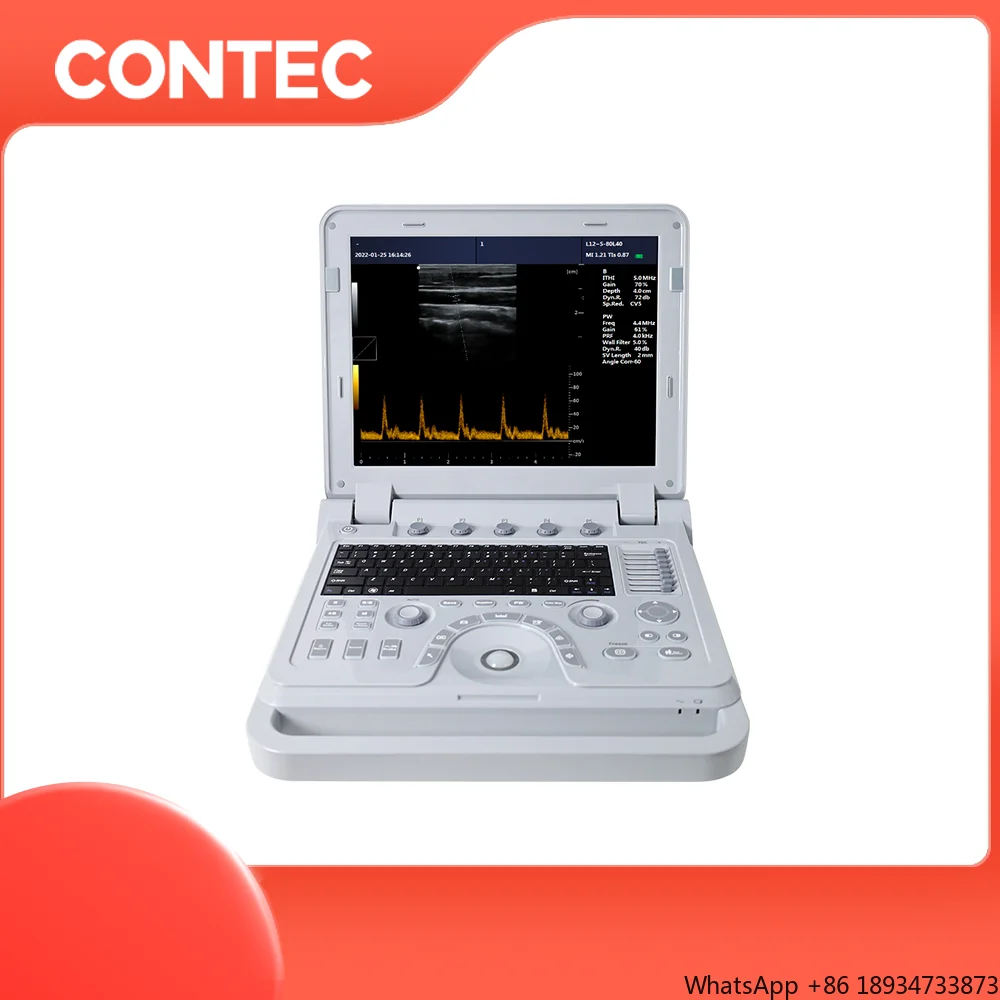 1700A цветной ультразвуковой допплер с портативностью