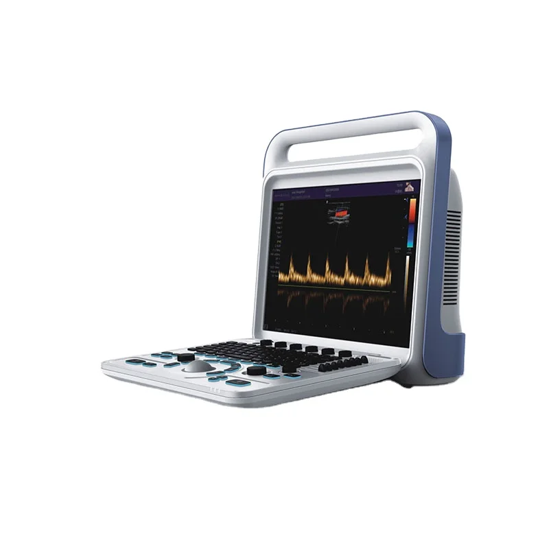 

portable color doppler ultrasound scanner for Hospital with CE ISO