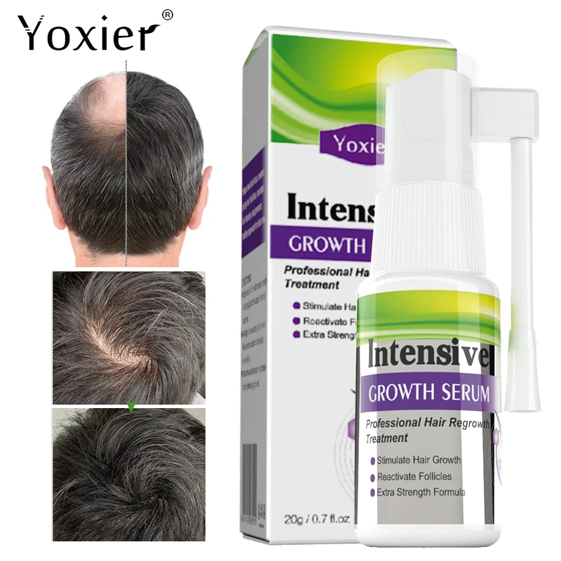 

Intensive Growth Serum Activate Hair Follicles Promote Growth Prevent Hair Loss Spray Deep Nourishment Repair Hair Care 20ml