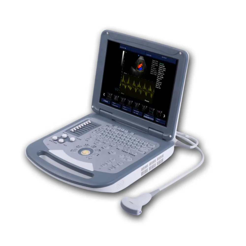 Краска допплер-Ultraschalls canner mit konvexer 3 5-MHz-Mehrfrequenz-bauchprobe