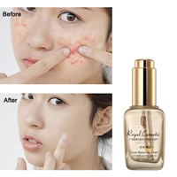 rungenyuan products for skin care sets whitening serum for dark skin lightening koreya face serum spot removal essence bioaqua