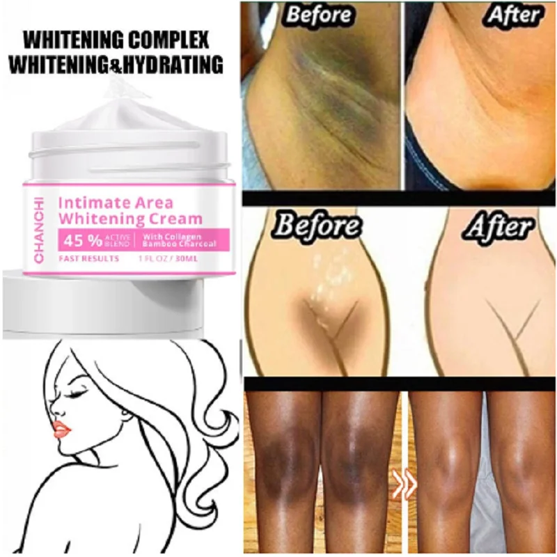 

Intimate Area Whitening Cream Underarm Knee Buttocks Remove Melanin Improve Pigmentation Moisturizing Brighten Beauty Cosmetics