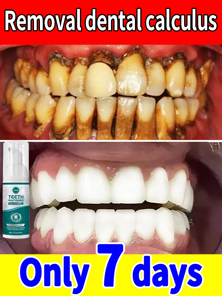 Резолирующий много Los Балка стоматологов