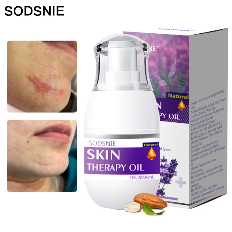 

Натуральное масло для тела стимулирует регенерацию клеток, удаляет рубцы тела, растяжки, отбеливает, улучшает неровный тон кожи, Терапевтич...