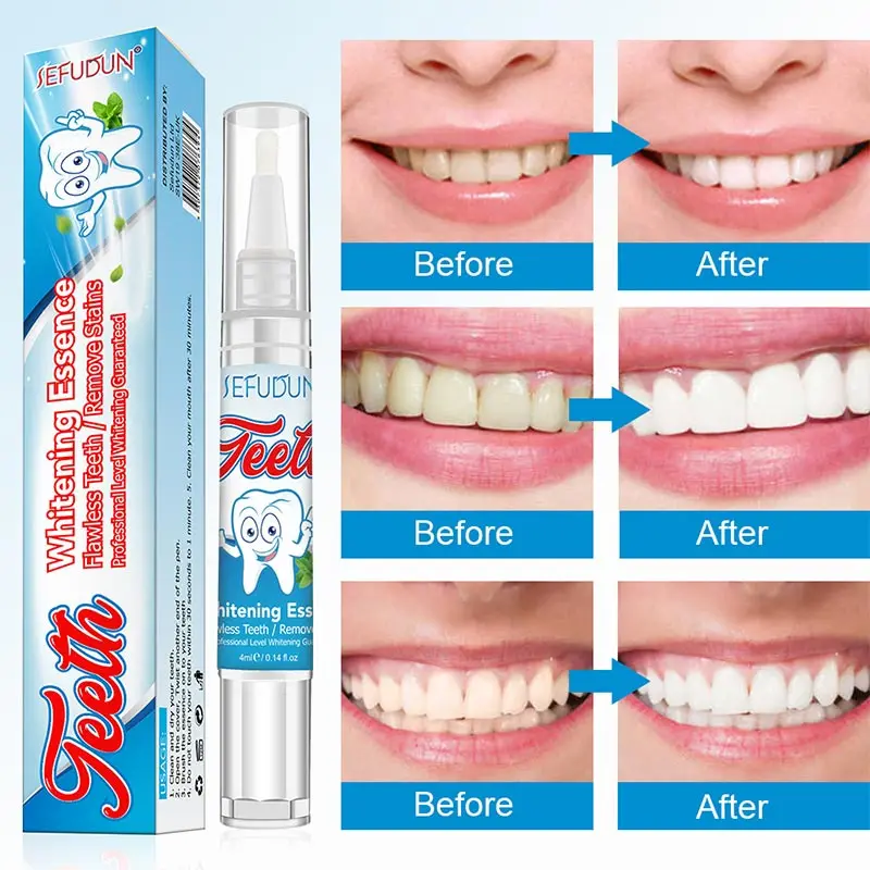 

Quickly White Teeth Gel Pen Oral Freshener Bright Whitening Tooth Pen Remove Smoke Tea Yellow Stains Toothpaste Smile Care