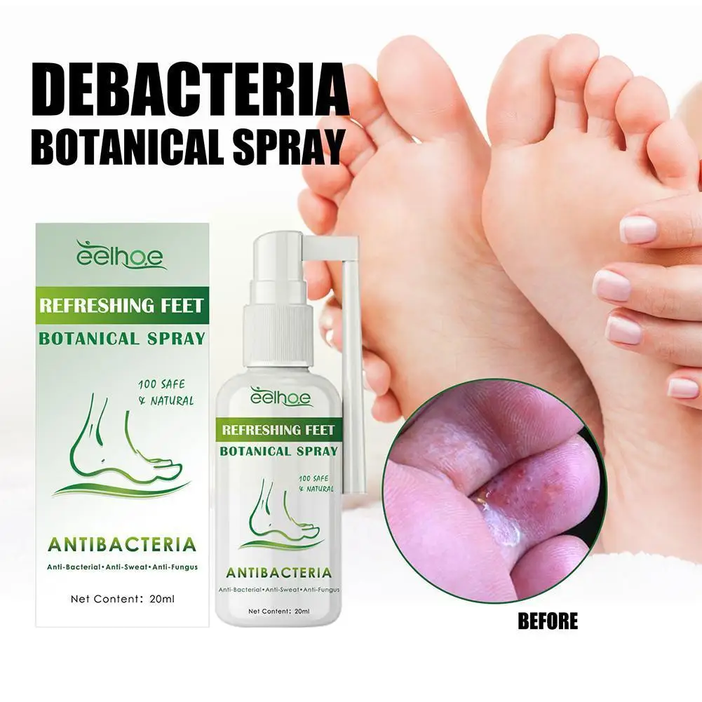 

Anti Fungal Spray Foot Fungal Cream Relieve Beriberi Toe Treatment Gel for Cracked Heel Peeling Blister Repairing Feet Oint K5B3