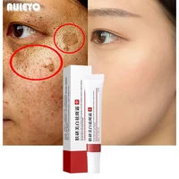 whitening freckle cream remove dark spots remove melasma anti freckle cream fade pigmentation skin anti aging skin care