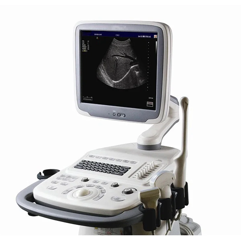 Портативный ультразвуковой аппарат Color Doppler Sonoscape S2 портативный