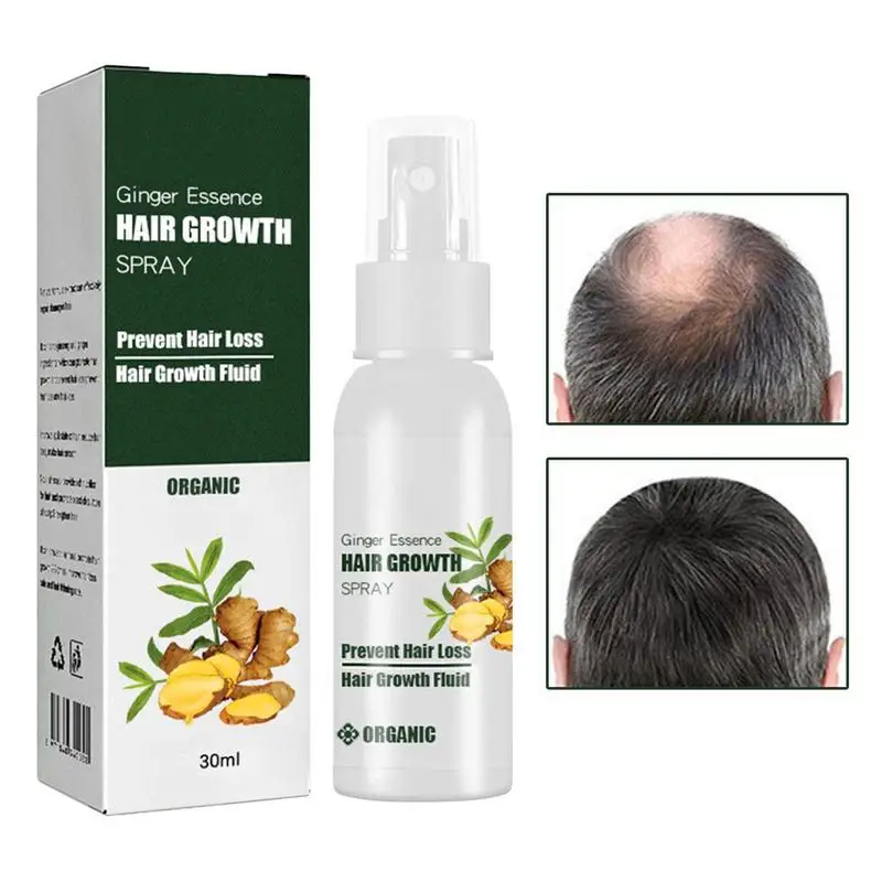 

Ginger Spray For Hair Loss Hair Thickening Essence 20ml Natural Scalp Care Ginger Essence For All Hair Types Moisturize Dry Hair