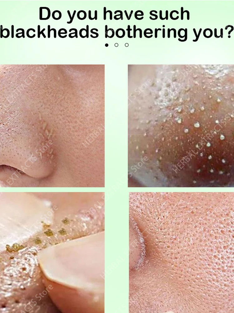 Маска с зеленым чаем от черных точек уход за кожей очистка лица сужение пор