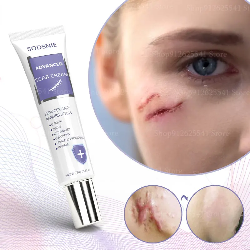 

Эффективное средство для удаления шрамов от растяжек, 20 г