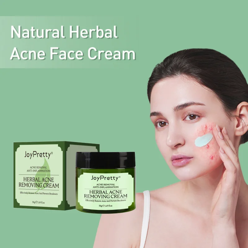

Acne Treatment Cream Herbal Anti-Acne Pimple Spot Scar Remove Shrink Pore Blackhead Remover Oil Control Korean Skin Care Product
