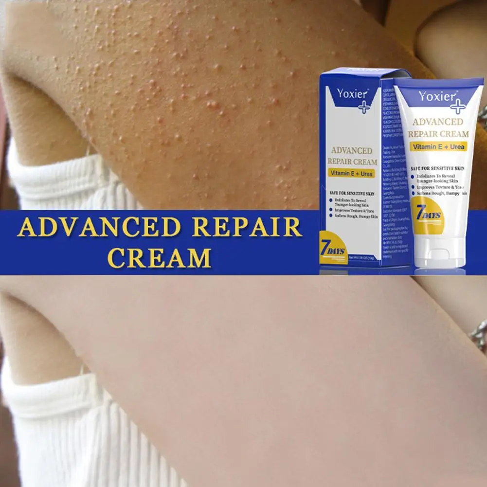 

Увлажняющий крем для тела, лечение кератоза, Pilaris, витамин E, отбеливание, смягчение грубой бумпи кожи, улучшение текстуры, тон 50 г