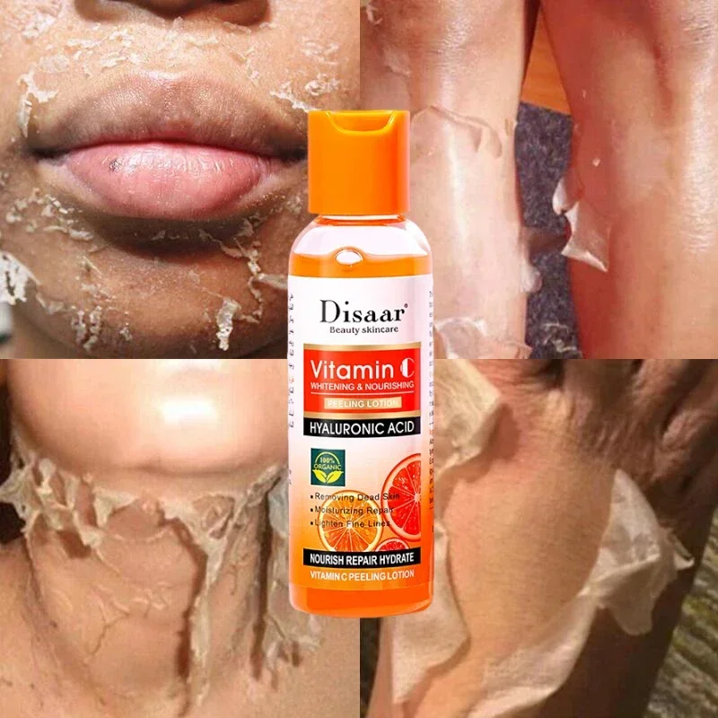 Желтый пилинг-лосьон-масло 100% органическое отбеливание для темной кожи