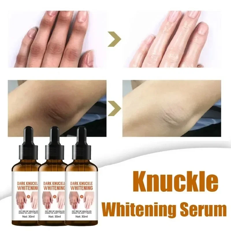 Осветляет кожу частных частей подмышек локтей осветляет меланин крем для рук