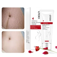 maternity scars stretch marks removal cream pregnancy scar acne treatment effective anti winkle firming repair body care product