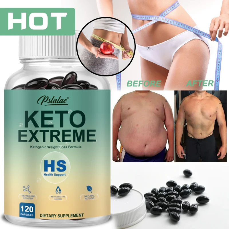 

Ketone Capsules, Burn Belly Fat, Suppress Appetite, Body Management, Provide Energy, Lose Weight, Enhance Immunity