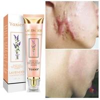 lavender scar removal cream stretch marks remove burn surgical scars face serum treatment smooth whitening face body skin care