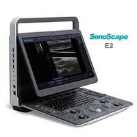 sonoscape e2 portable laptop ultrasound color doppler system inspection camera usb camera endoscope %d9%83%d8%a7%d9%85%d9%8a%d8%b1%d8%a7