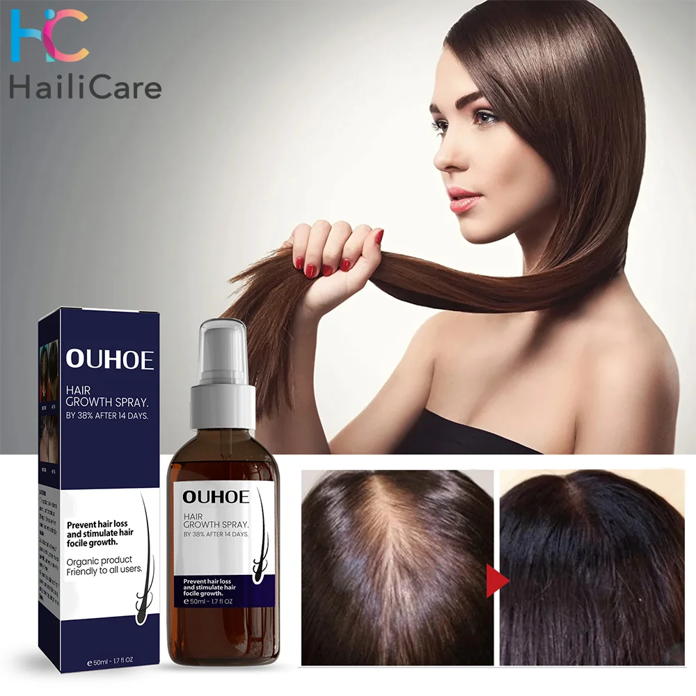 

Fast Hair Growth Spray Anti Hair Loss Product Prevent Thinning Dry Frizzy Repair Damaged Strong Hair Root Essence Hair Care