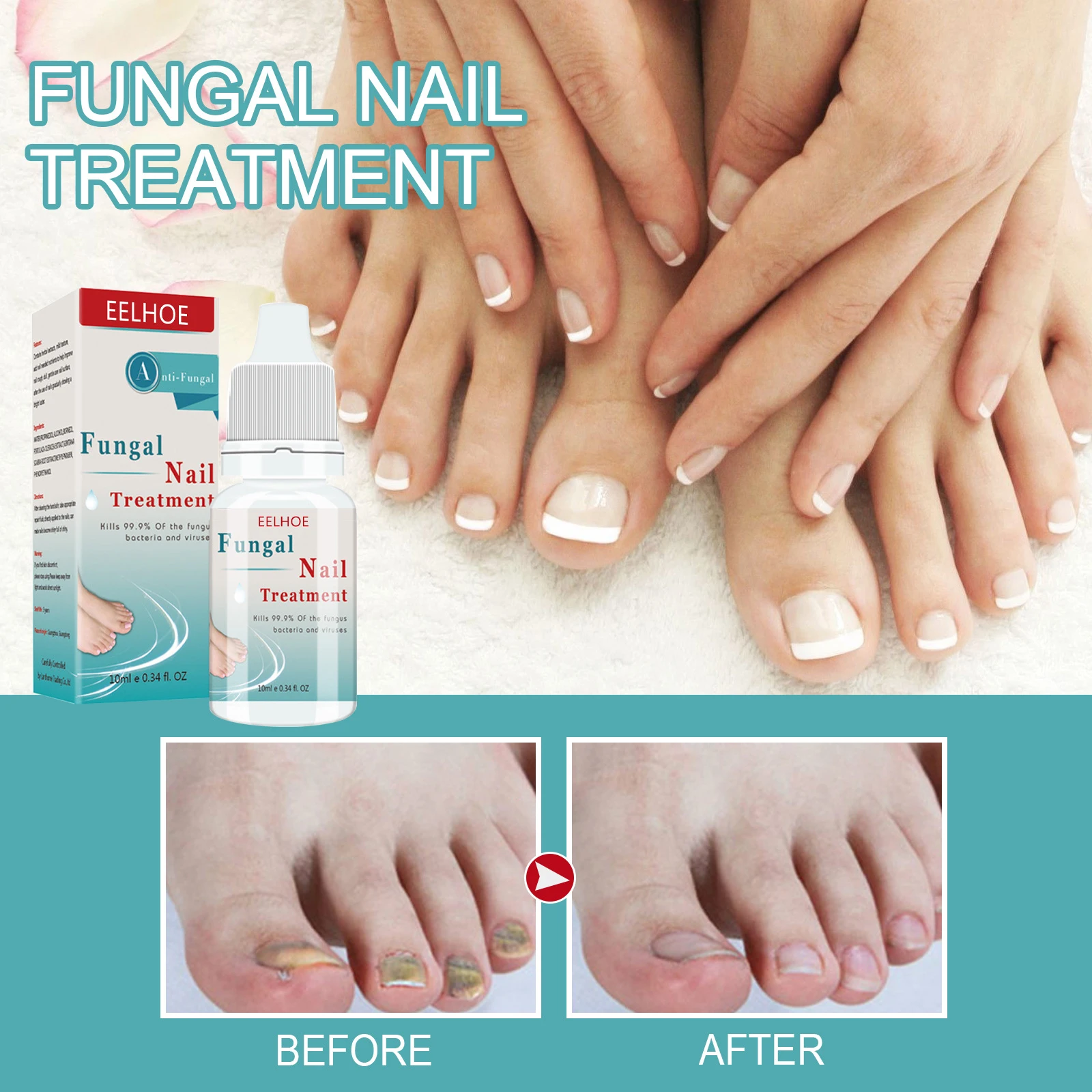 

Nail Repair Essence Fungal Nail Treatment Serum Removal Onychomycosis Paronychia Anti Fungus Infection Toe Nail Nourishing 10ml
