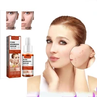 salicylic acid essence is suitable for multi skin essence brightening dark yellow shrinking pores and acne marks