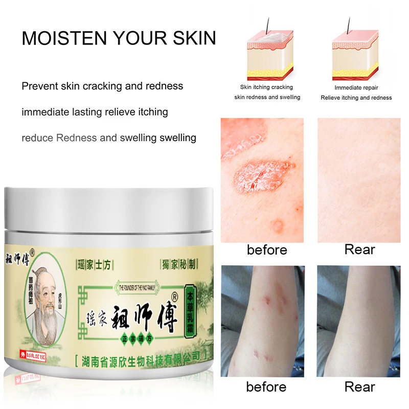 Рисунок 2 - Антибактериальный и восстанавливающий