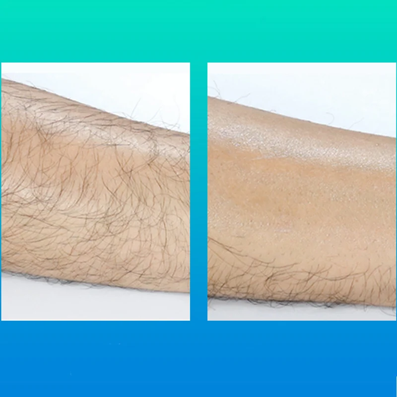 Нежное удаление волос отшелушивающий уход за лицом и телом профессиональный