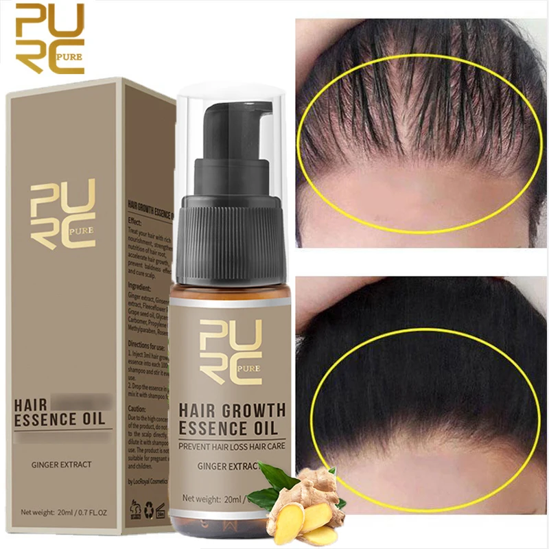 PURC Ginger Hair Growth Spray Fast Grow Anti Hair Loss Essential Oil Prevent Dry Frizzy Herbal Scalp Treatment Nourish Hair Care