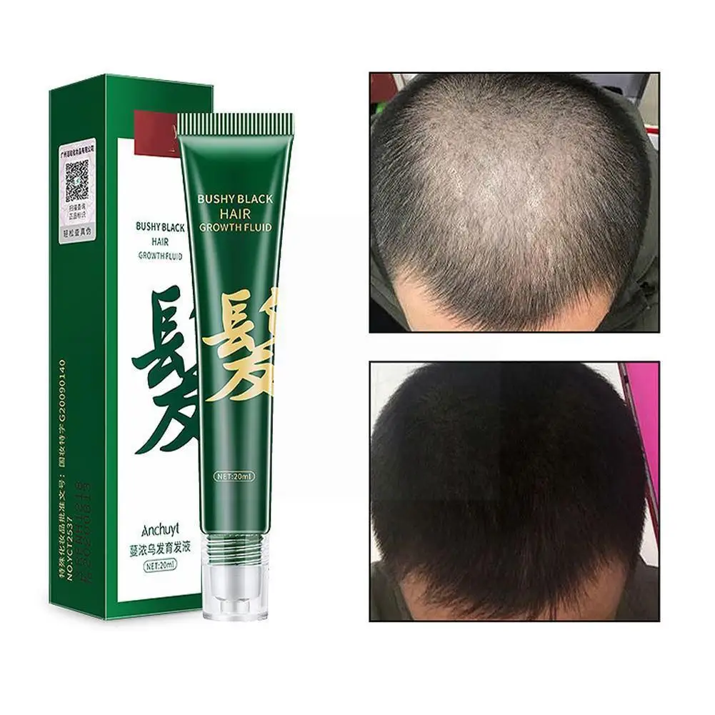 

20ml Fast Hair Growth Serum Roller Hair Care Hair Growth Liquid Hair Hair Nourishing Oils Sential Treatment Thick Loss T8k8