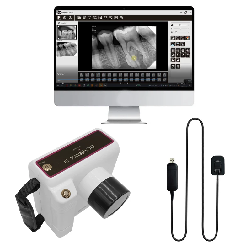 

Hot Sale Portable Xray Machine Digital RVG Dental X Ray Sensor Price