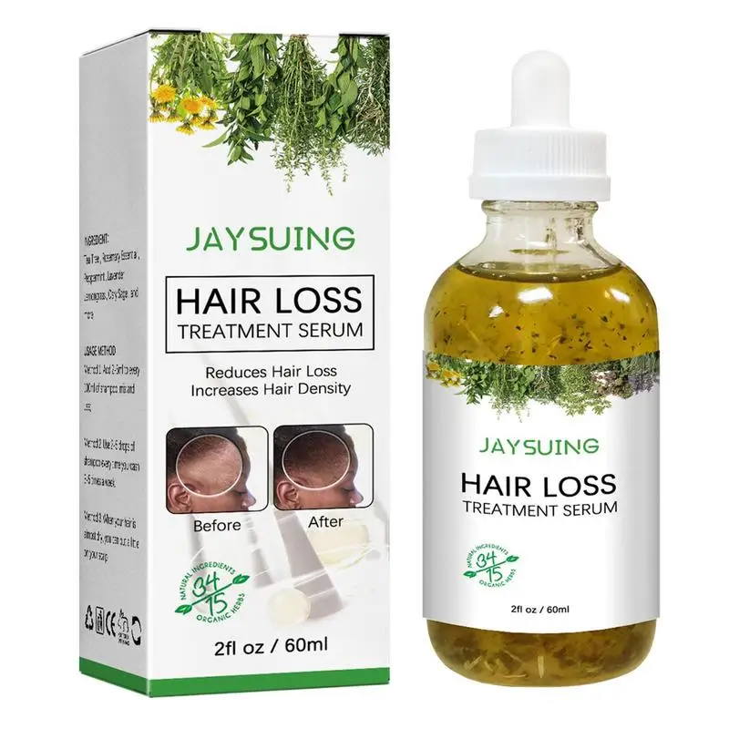 

Sdotter Hair Loss Essence Hair Growth Oil Essence 2oz Hair Oil With Natural Extracts For Stronger Thicker Scalp Oil Promotes Hai