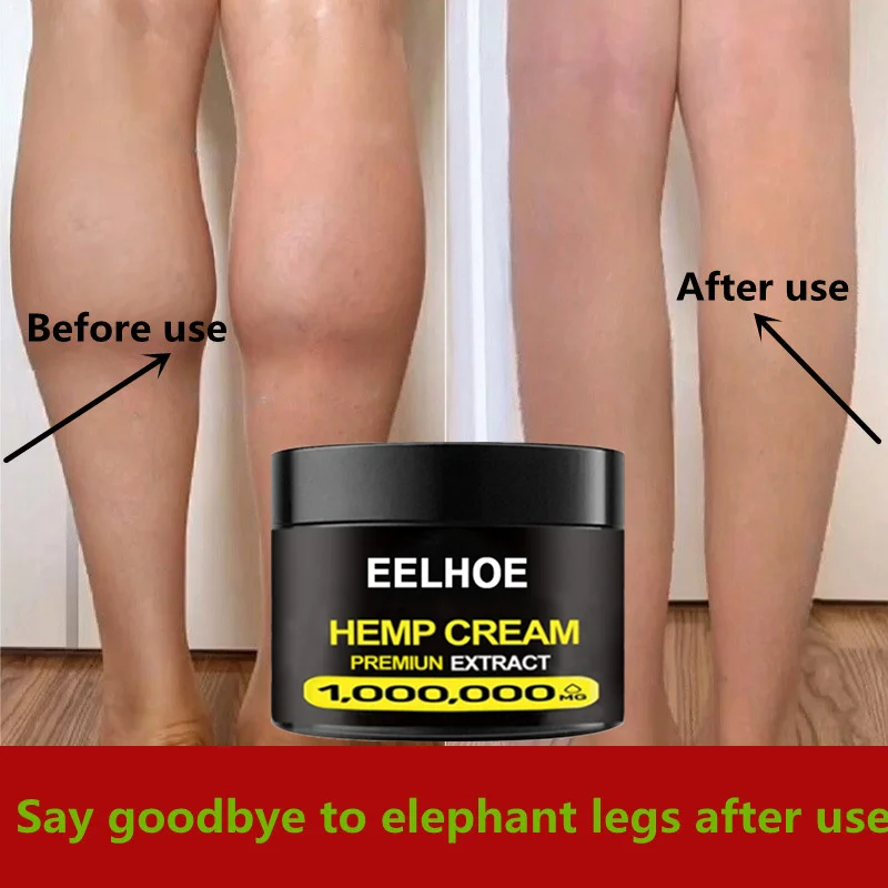 

Powerful Weight Loss Cream Abdominal Muscle Cream/muscle Essential Oil Fat Burning Fat Weight Loss Slimming Abdominal Tightening
